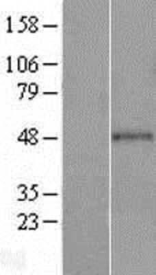 Western Blot: GRAMD3 Overexpression Lysate [NBL1-11322]