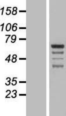 Western Blot: GRAMD4 Overexpression Lysate [NBP2-07212]