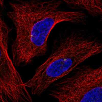 Immunocytochemistry/ Immunofluorescence: GRAP Antibody [NBP2-55979]