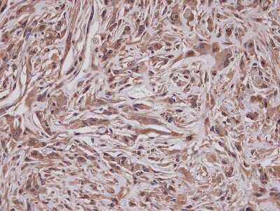 Immunohistochemistry-Paraffin: GRAP Antibody [NBP1-33626]