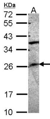 Western Blot: GRAP Antibody [NBP1-33626]