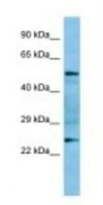 Western Blot: GRAP Antibody [NBP1-98421]