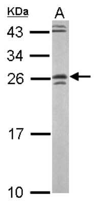 Western Blot: GRAP Antibody [NBP2-16737]