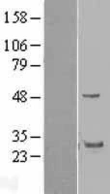 Western Blot: GRAP Overexpression Lysate [NBL1-11323]