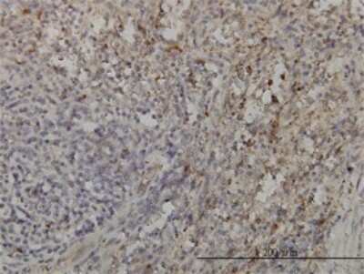 Immunohistochemistry-Paraffin: GRAP2 Antibody (1G12) [H00009402-M01]