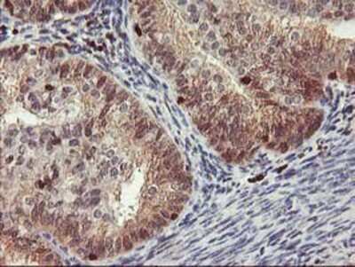Immunohistochemistry-Paraffin: GRAP2 Antibody (OTI1G2) [NBP2-00764]