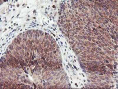 Immunohistochemistry-Paraffin: GRAP2 Antibody (OTI1G2) [NBP2-00764]