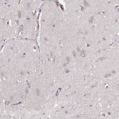 Immunohistochemistry-Paraffin: GRAP2 Antibody [NBP1-83399]