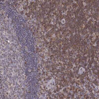 Immunohistochemistry-Paraffin: GRAP2 Antibody [NBP1-83399]