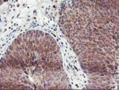 Immunohistochemistry: GRAP2 Antibody (OTI1G2) - Azide and BSA Free [NBP2-71457]