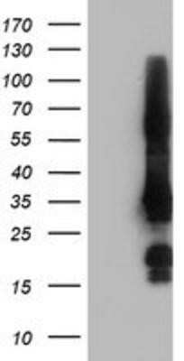 Western Blot: GRAP2 Antibody (OTI1G2)Azide and BSA Free [NBP2-71457]