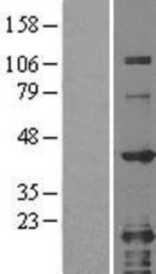 Western Blot: GRAP2 Overexpression Lysate [NBL1-11324]