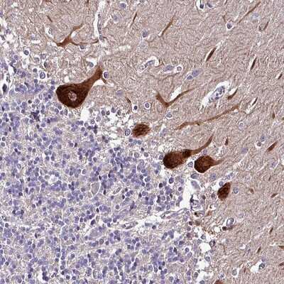 Immunohistochemistry-Paraffin: GRAPL Antibody [NBP2-14745]