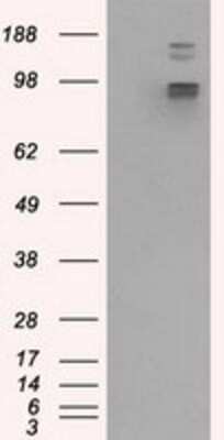 Western Blot: GRASP1 Antibody (OTI1E3) [NBP2-02277]