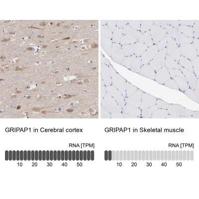 Immunohistochemistry-Paraffin: GRASP1 Antibody [NBP1-85103]