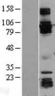 Western Blot: GRASP1 Overexpression Lysate [NBL1-11341]