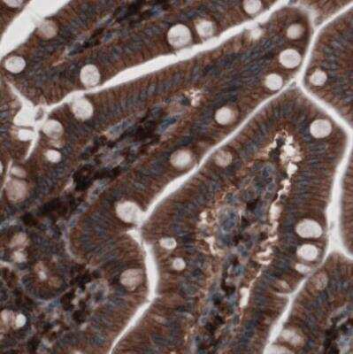 Immunohistochemistry: GRASP55 Antibody (CL2522) [NBP2-36769]