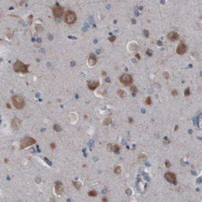 Immunohistochemistry: GRASP55 Antibody (CL2522) [NBP2-36769]