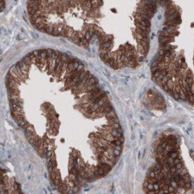 Immunohistochemistry: GRASP55 Antibody (CL2522) [NBP2-36769]