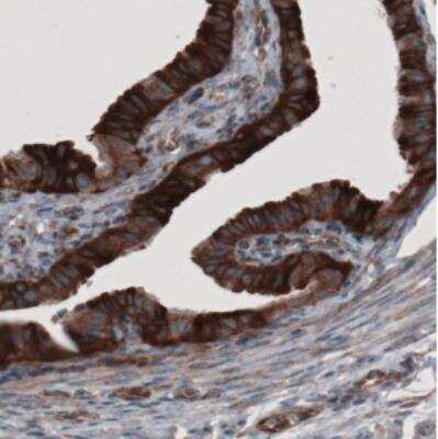 Immunohistochemistry: GRASP55 Antibody (CL2522) [NBP2-36769]
