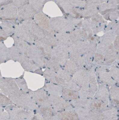 Immunohistochemistry: GRASP55 Antibody (CL2522) [NBP2-36769]