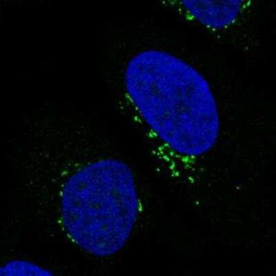 Immunocytochemistry/ Immunofluorescence: GRASP55 Antibody (CL2610) [NBP2-36779]