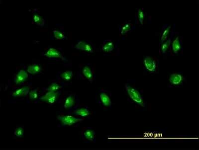 Immunocytochemistry/ Immunofluorescence: GRASP55 Antibody [H00026003-B01P]
