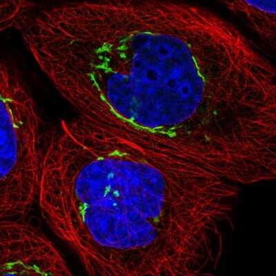 Immunocytochemistry/ Immunofluorescence: GRASP55 Antibody [NBP2-38244]