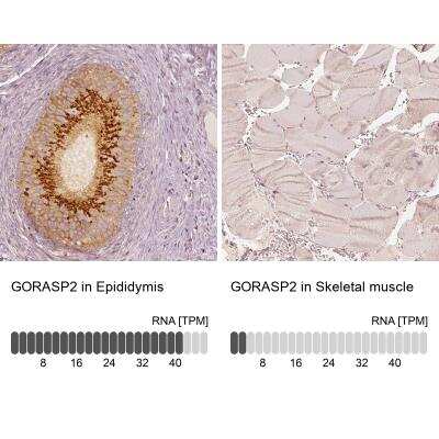 Immunohistochemistry-Paraffin: GRASP55 Antibody [NBP2-38244]