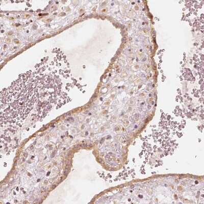 Immunohistochemistry-Paraffin: GRASP55 Antibody [NBP2-38244]