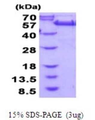 SDS-PAGE: Recombinant Human GRASP55 His Protein [NBP2-51980]