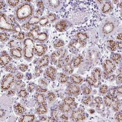 Immunohistochemistry: GRASP65 Antibody [NBP2-47443]