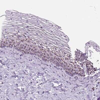 Immunohistochemistry-Paraffin: GRASP65 Antibody [NBP2-47443]