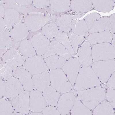 Immunohistochemistry-Paraffin: GRASP65 Antibody [NBP2-47443]