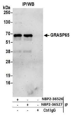 Immunoprecipitation: GRASP65 Antibody [NBP2-36526]