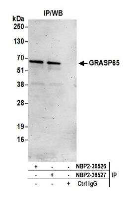 Immunoprecipitation: GRASP65 Antibody [NBP2-36527]
