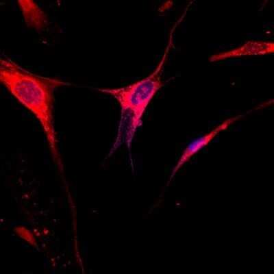 Immunocytochemistry/ Immunofluorescence: GRASP65 Antibody (OTI5G8) - Azide and BSA Free [NBP2-72144]