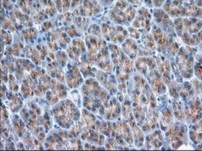 Immunohistochemistry: GRASP65 Antibody (OTI5G8) - Azide and BSA Free [NBP2-72144]