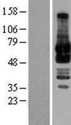 Western Blot: GRASP65 Overexpression Lysate [NBL1-11202]