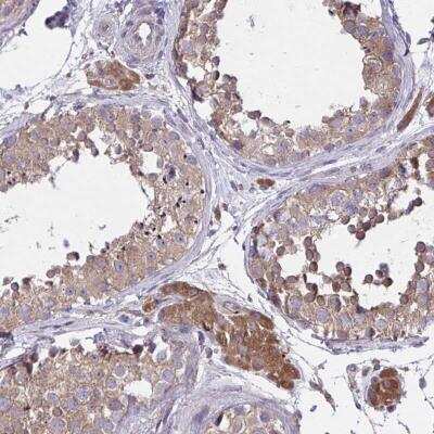 Immunohistochemistry-Paraffin: GRB 14 Antibody [NBP2-38230]