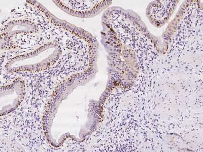 Immunohistochemistry-Paraffin: GRB 14 Antibody [NBP2-97218]