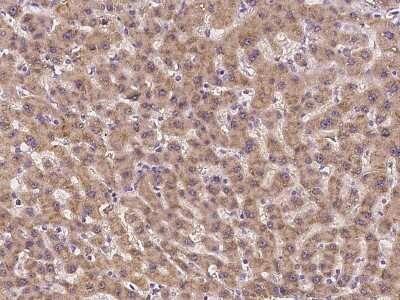 Immunohistochemistry-Paraffin: GRB 14 Antibody [NBP2-97218]