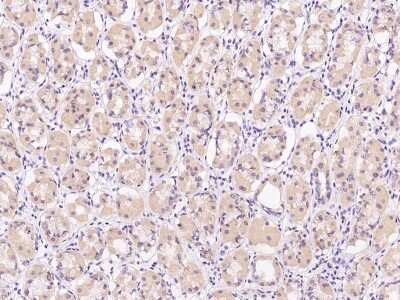 Immunohistochemistry-Paraffin: GRB 14 Antibody [NBP2-97218]