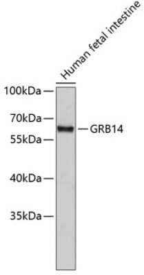 Western Blot: GRB 14 AntibodyAzide and BSA Free [NBP2-94010]