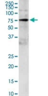 Western Blot: GRB10 Antibody (1A7) [H00002887-M01]