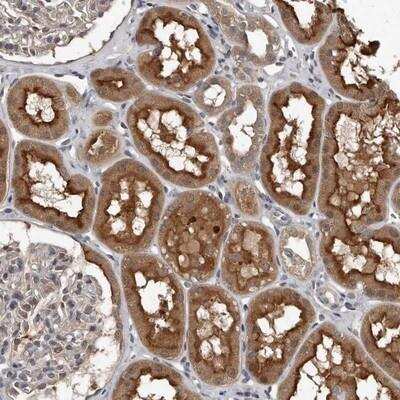 Immunohistochemistry: GRB10 Antibody [NBP1-86387]