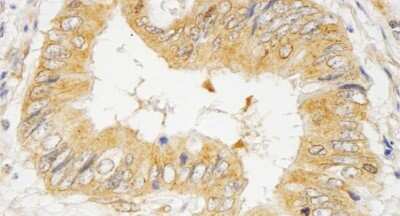 Immunohistochemistry-Paraffin: GRB10 Antibody [NB100-88153]