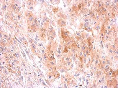Immunohistochemistry-Paraffin: GRB10 Antibody [NBP2-16741]