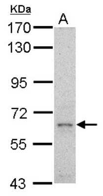 Western Blot: GRB10 Antibody [NBP2-16741]