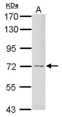 Western Blot: GRB10 Antibody [NBP2-16742]